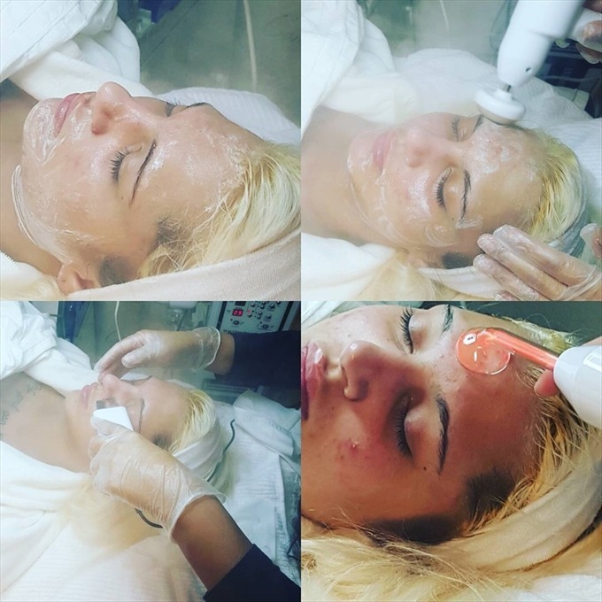 AkneKontroll-Forever-Beauty-Klinik-Academy